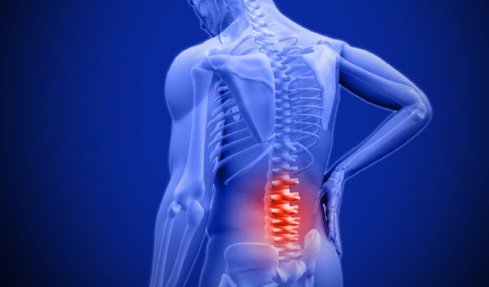low-back-pain