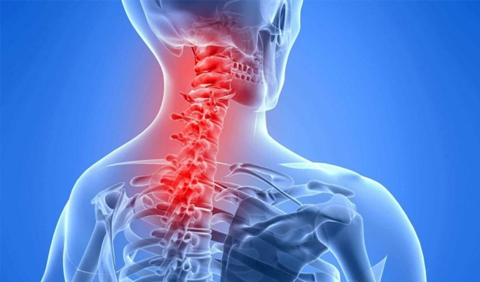 neck-pain