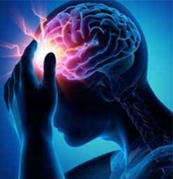 Epilepsy