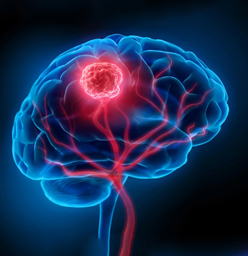 brain-tumor