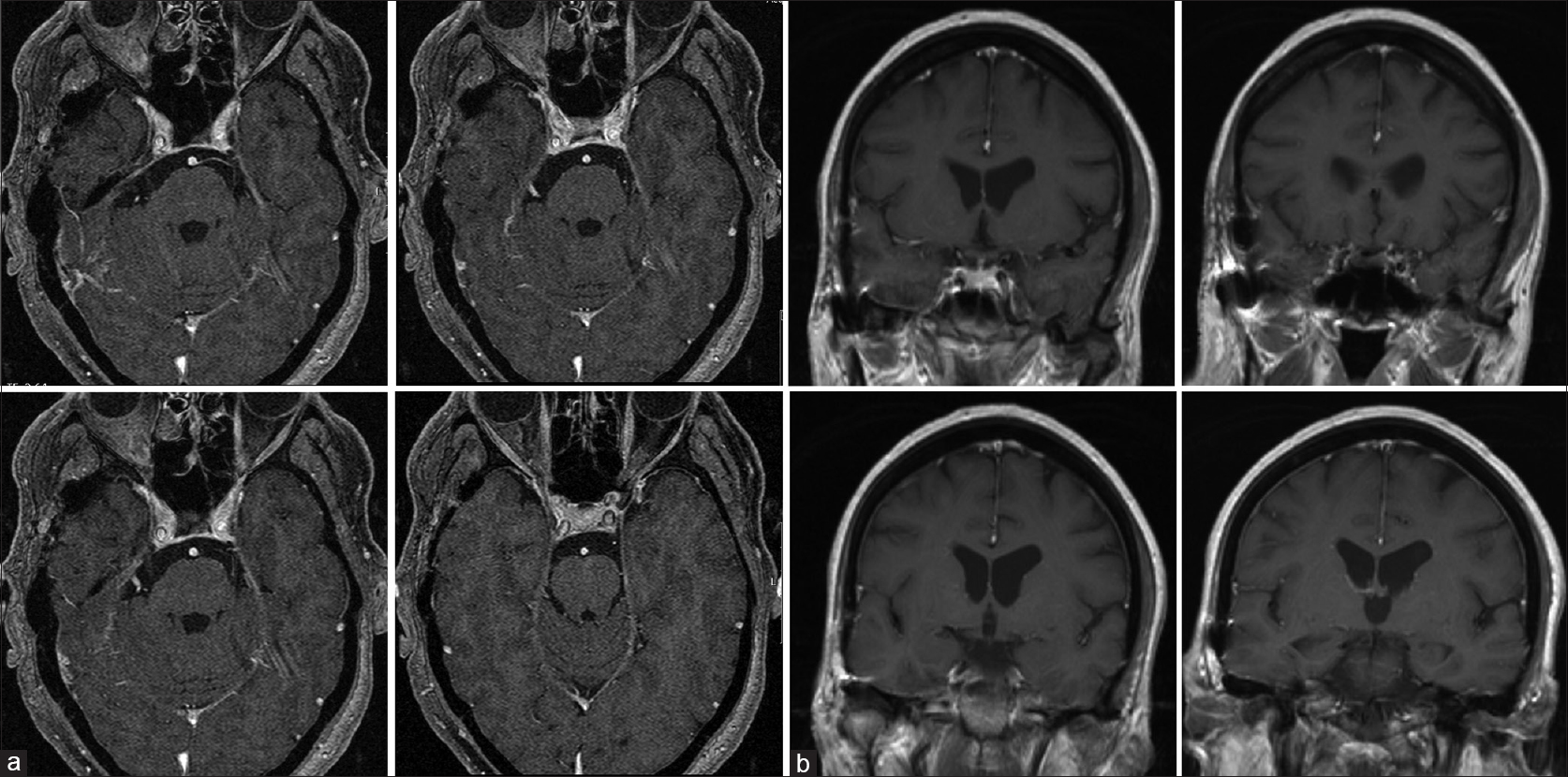 best neurosurgeon in lucknow